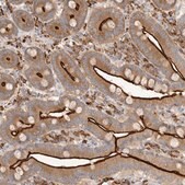 Anti-USH1C antibody produced in rabbit Prestige Antibodies&#174; Powered by Atlas Antibodies, affinity isolated antibody, buffered aqueous glycerol solution, ab1