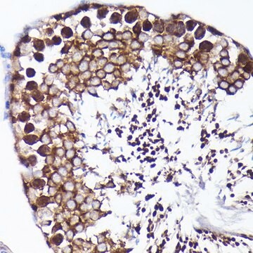 Anti-PRMT5 antibody produced in rabbit