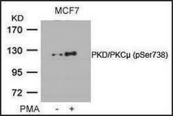 Anti-phospho-PRKD1 (pSer738) antibody produced in rabbit affinity isolated antibody
