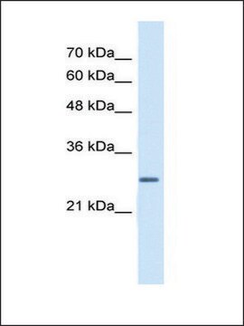 Anti-ECHS1 (AB1) antibody produced in rabbit IgG fraction of antiserum