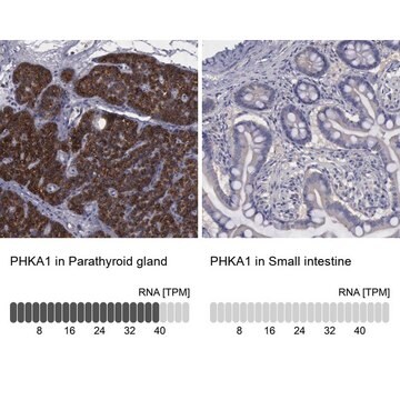 Anti-PHKA1 antibody produced in rabbit Prestige Antibodies&#174; Powered by Atlas Antibodies, affinity isolated antibody, buffered aqueous glycerol solution