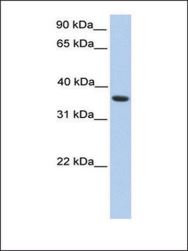 Anti-MAGEA4 antibody produced in rabbit affinity isolated antibody