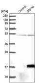 Anti-DEFA5 antibody produced in rabbit Prestige Antibodies&#174; Powered by Atlas Antibodies, affinity isolated antibody, buffered aqueous glycerol solution