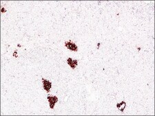 Monoclonal Anti-Insulin antibody produced in mouse clone K36AC10, ascites fluid