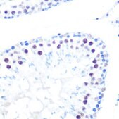 Anti-HDAC9 Antibody, clone 3L5E5, Rabbit Monoclonal