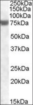 Anti-FEM1A (C-terminal) antibody produced in goat affinity isolated antibody, buffered aqueous solution