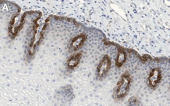 Anti-Rac1 Antibody, clone 1E9 ZooMAb&#174; Rabbit Monoclonal recombinant, expressed in HEK 293 cells