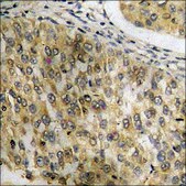 Anti-phospho-STAT6 (pTyr641) antibody produced in rabbit affinity isolated antibody