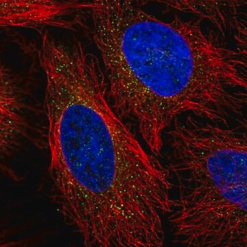 Anti-LPL antibody produced in rabbit Prestige Antibodies&#174; Powered by Atlas Antibodies, affinity isolated antibody