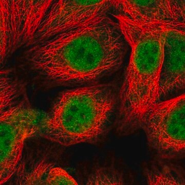 Anti-MGMT antibody produced in rabbit Prestige Antibodies&#174; Powered by Atlas Antibodies, affinity isolated antibody