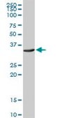 Anti-ATP1B3 antibody produced in rabbit purified immunoglobulin, buffered aqueous solution