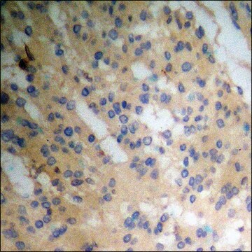 Anti-phospho-Smad1 (pSer465) antibody produced in rabbit affinity isolated antibody