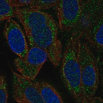 Anti-Hars2 Antibody Produced In Rabbit Prestige Antibodies&#174; Powered by Atlas Antibodies, affinity isolated antibody, buffered aqueous glycerol solution