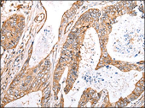 Anti-KCTD16 affinity isolated antibody