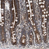 Anti-OGDH antibody produced in rabbit Prestige Antibodies&#174; Powered by Atlas Antibodies, affinity isolated antibody, buffered aqueous glycerol solution