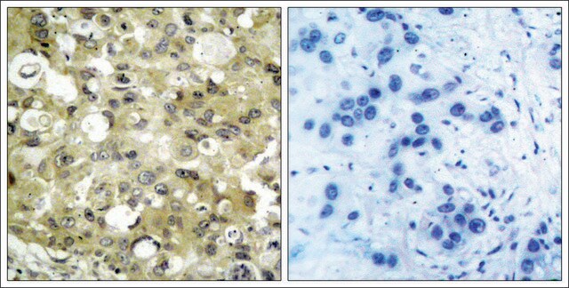 Anti-KDR (Ab-951) antibody produced in rabbit affinity isolated antibody