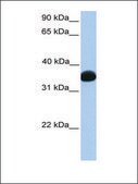 Anti-LDHB affinity isolated antibody
