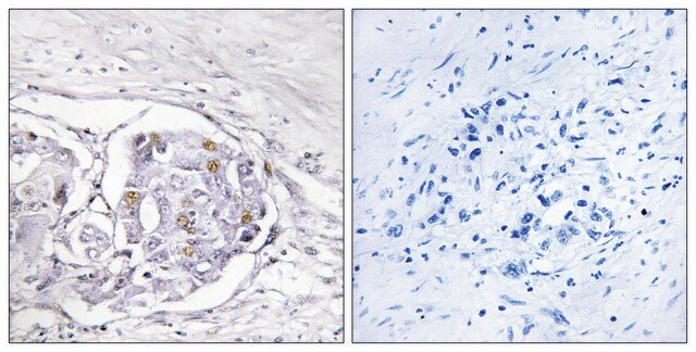 Anti-Progesterone Receptor antibody produced in rabbit affinity isolated antibody