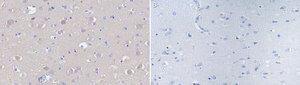 Anti-Nitrotyrosine Antibody Upstate&#174;, from rabbit