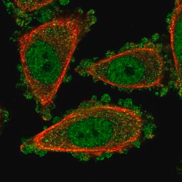 Anti-UROD antibody produced in rabbit Prestige Antibodies&#174; Powered by Atlas Antibodies, affinity isolated antibody