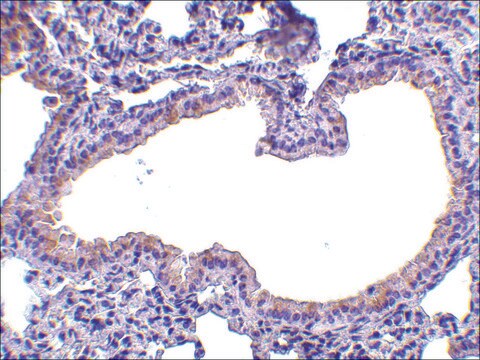 Anti-SLPI (ab2) antibody produced in rabbit affinity isolated antibody, buffered aqueous solution