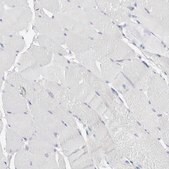 Anti-CASP6 antibody produced in rabbit Prestige Antibodies&#174; Powered by Atlas Antibodies, affinity isolated antibody, buffered aqueous glycerol solution