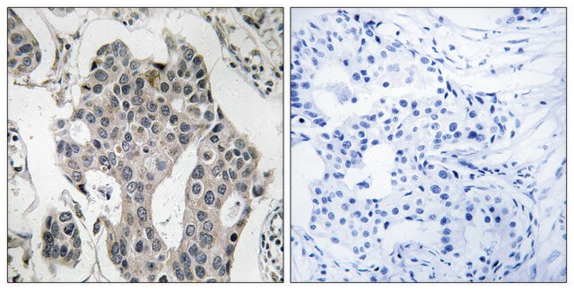 Anti-RAB3GAP2 antibody produced in rabbit affinity isolated antibody