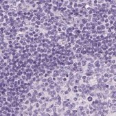 Anti-LGSN antibody produced in rabbit Prestige Antibodies&#174; Powered by Atlas Antibodies, affinity isolated antibody