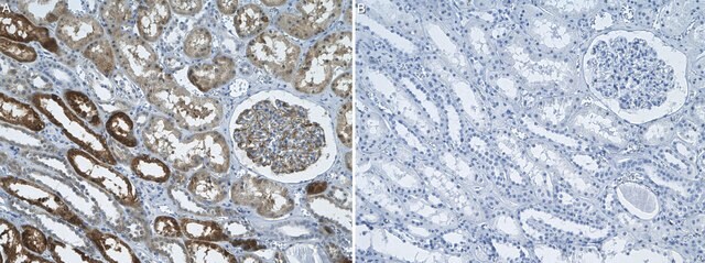 Anti-Nephrin Antibody, clone 1D16 ZooMAb&#174; Rabbit Monoclonal recombinant, expressed in HEK 293 cells