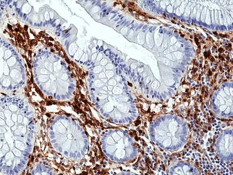 Anti-Annexin A1 Rabbit Monoclonal Antibody clone RM424, affinity purified immunoglobulin