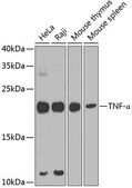 Anti-TNF-&#945; antibody produced in rabbit