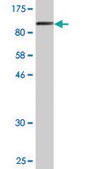 Monoclonal Anti-LIMA1, (N-terminal) antibody produced in mouse clone 1B7, purified immunoglobulin, buffered aqueous solution