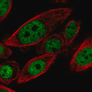 Anti-CYHR1 antibody produced in rabbit Prestige Antibodies&#174; Powered by Atlas Antibodies, affinity isolated antibody