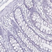 Anti-CA9 antibody produced in rabbit Prestige Antibodies&#174; Powered by Atlas Antibodies, affinity isolated antibody, buffered aqueous glycerol solution