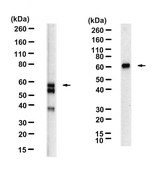 Anti-CA9 Antibody, clone 1B6 ZooMAb&#174; Rabbit Monoclonal recombinant, expressed in HEK 293 cells
