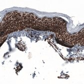 Anti-TSPO antibody produced in mouse Prestige Antibodies&#174; Powered by Atlas Antibodies, clone CL13358, purified by using Protein A, buffered aqueous glycerol solution