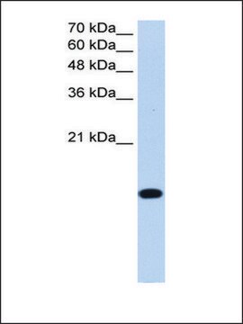 Anti-BATF2 antibody produced in rabbit affinity isolated antibody