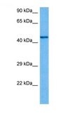 Anti-CHRNB2 antibody produced in rabbit affinity isolated antibody
