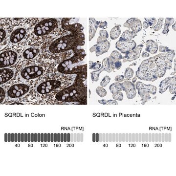 Anti-SQRDL antibody produced in rabbit Prestige Antibodies&#174; Powered by Atlas Antibodies, affinity isolated antibody, buffered aqueous glycerol solution