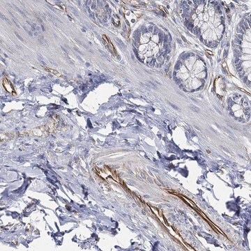 Anti-Thsd1 Antibody Produced In Rabbit Prestige Antibodies&#174; Powered by Atlas Antibodies, affinity isolated antibody, buffered aqueous glycerol solution