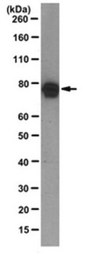 Anti-Exo70 Antibody, clone 70X13F3 clone 70X13F3, from mouse