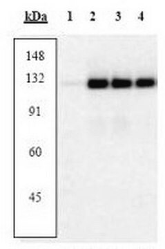 PhosphoDetect Anti-FAK (pTyr&#8312;&#8310;&#185;) Rabbit pAb liquid, Calbiochem&#174;