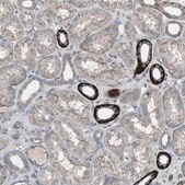 Anti-SSTR2 antibody produced in rabbit Prestige Antibodies&#174; Powered by Atlas Antibodies, affinity isolated antibody, buffered aqueous glycerol solution