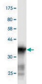 Monoclonal Anti-SCN3A antibody produced in mouse clone 2F8, purified immunoglobulin, buffered aqueous solution