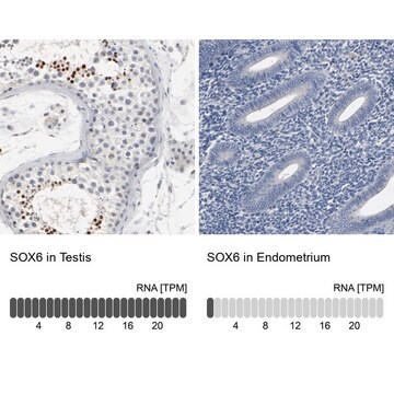 Anti-SOX6 antibody produced in rabbit Ab2, Prestige Antibodies&#174; Powered by Atlas Antibodies, affinity isolated antibody, buffered aqueous glycerol solution