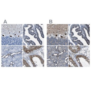 Anti-STIM1 antibody produced in rabbit Prestige Antibodies&#174; Powered by Atlas Antibodies, affinity isolated antibody, buffered aqueous glycerol solution