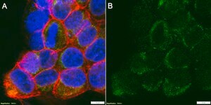 Anti-CA9 Antibody, clone 1B6 ZooMAb&#174; Rabbit Monoclonal recombinant, expressed in HEK 293 cells