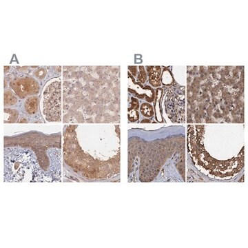 Anti-PSMD9 antibody produced in rabbit Prestige Antibodies&#174; Powered by Atlas Antibodies, affinity isolated antibody, buffered aqueous glycerol solution
