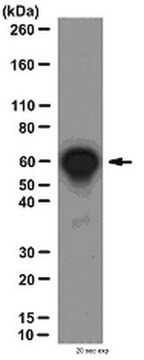 Anti-NF&#954;B p65 Antibody, CT from rabbit