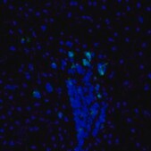 Anti-PBK antibody produced in rabbit affinity isolated antibody, buffered aqueous glycerol solution